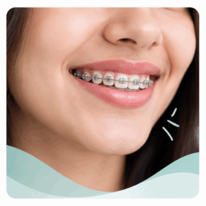 Personalised Braces Treatment
